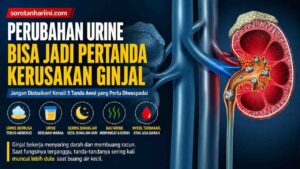 Pertanda Kerusakan Ginjal, Perubahan Urine yang Sering Diabaikan Namun Krusial