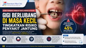 Studi: Gigi Berlubang di Masa Kecil Tingkatkan Risiko Penyakit Jantung