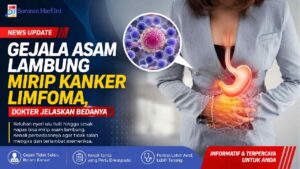 Gejala Asam Lambung Mirip Kanker Limfoma, Dokter Jelaskan Bedanya
