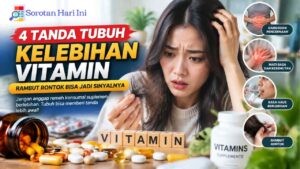 4 Tanda Tubuh Kelebihan Vitamin, Rambut Rontok Bisa Jadi Sinyalnya