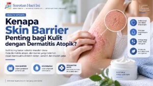 Kenapa Skin Barrier Penting bagi Kulit dengan Dermatitis Atopik?